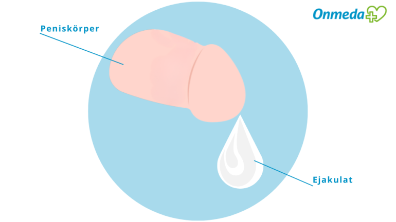 Jinsiy zoravonliklarni tomosha qiling